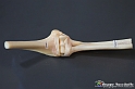 VBS_3084 - Articolazione del gomito - Mostra Body Worlds